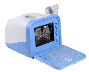 Digital Ultrasound
