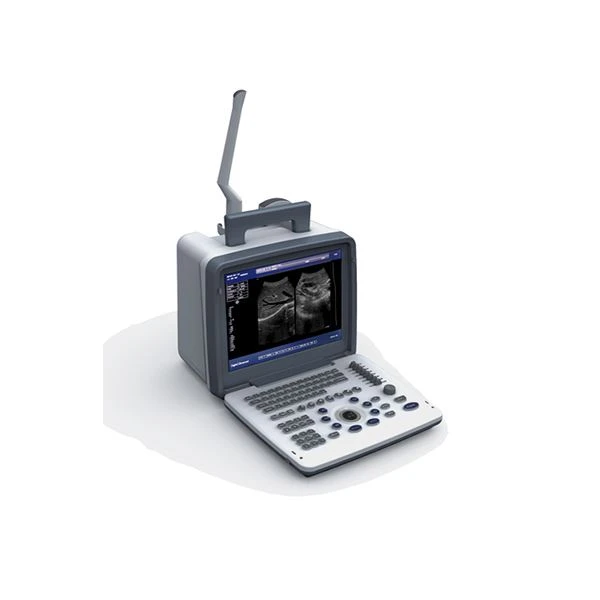 portable ultrasound portable ultrasound