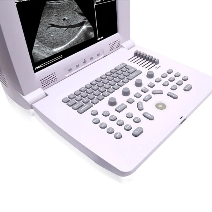 	B/W Portable Ultrasound Scanner