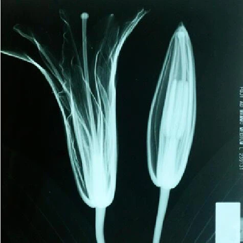 Medical Digital Mammography X-Ray System Image