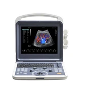 סורק דופלר צבע נייד תלת-ממדי/4D