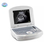 סורק אולטרסאונד נייד YJ-U308 סין