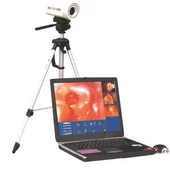 Dndoscope אלקטרוני וידאו צבעוני קולפוסקופ דיגיטלי Sony